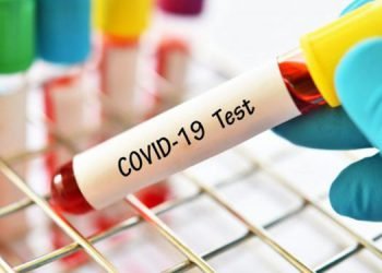 ASSAM COVID SPIKE : 123 cases detected on Sunday , tally shoots to 1339