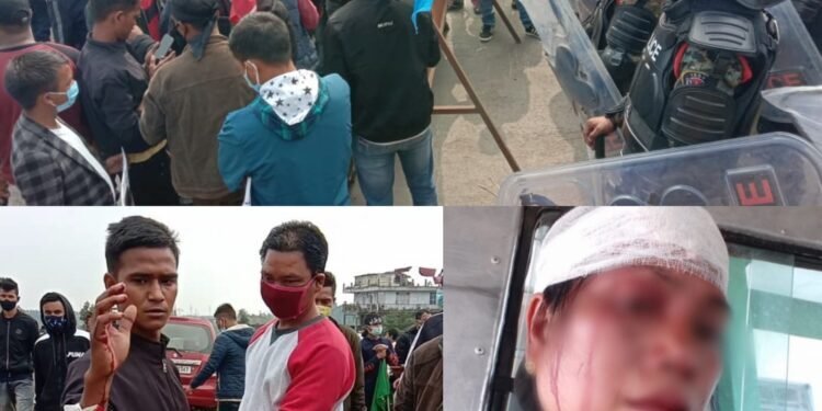 Meghalaya: 7 police personnel injured during protest at public hearing site