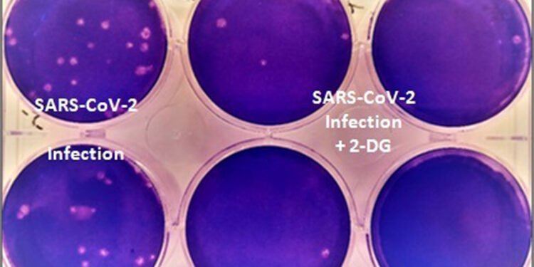 DCGI approves anti-COVID drug developed by DRDO for emergency use