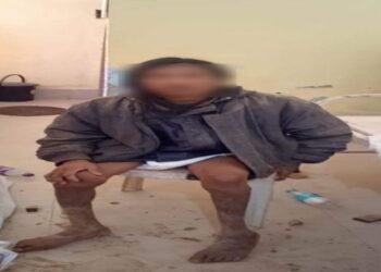 Mentally unstable man held captive for 8 years finally rescued by police
